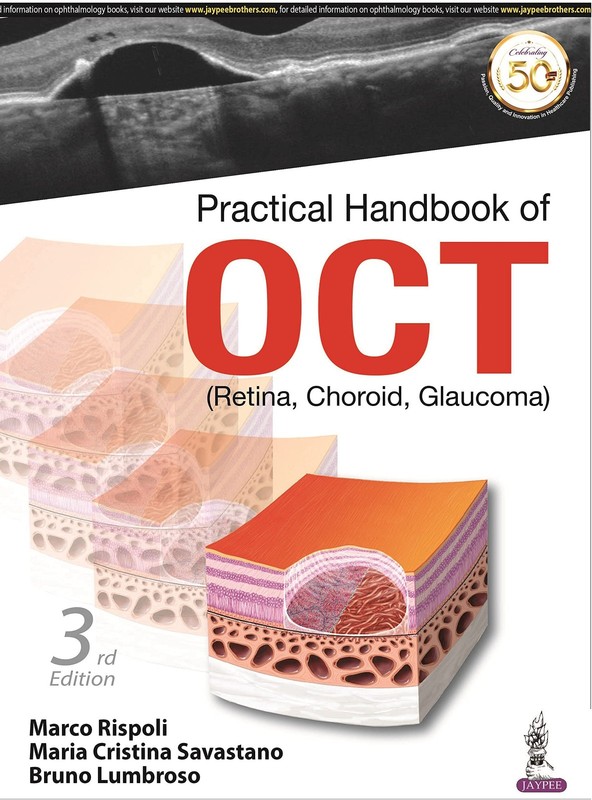 PRACTICAL HANDBOOK OF OCT (RETINA,CHORID,GLAUCOMa) by Marco, M.D. Rispoli