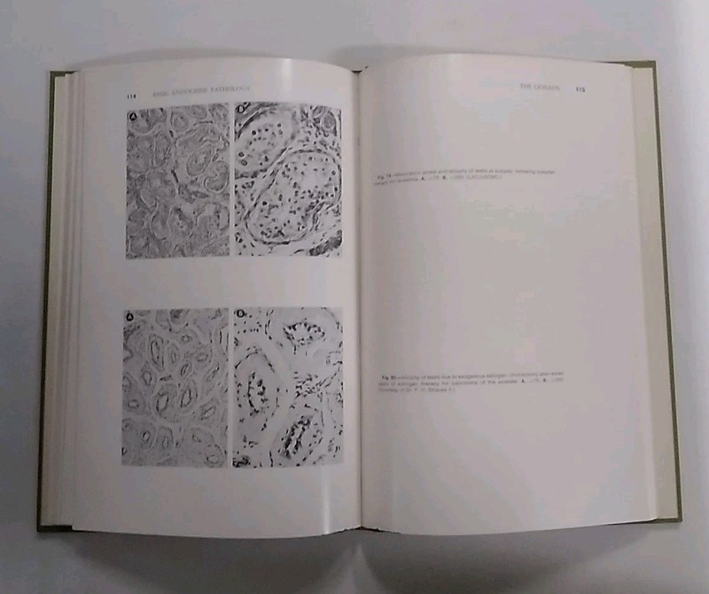 Basic Endocrine Pathology, Nancy E. Warner. Pub. 1971. HB, Very Good Condition gallery