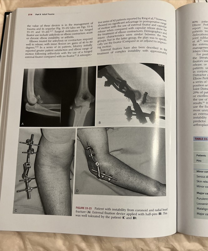 Morrey's The Elbow and Its Disorders: Expert Consult - Online and Print gallery