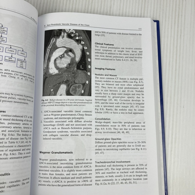 Clinically Oriented Pulmonary Imaging by Jeffrey Kanne Respiratory Medicine HC gallery