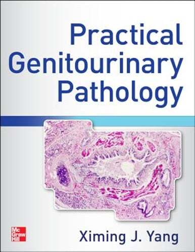 Atlas of Practical Genitourinary Pathology by Ximing James Yang: New